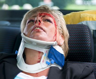 Do I Need an Attorney After a Car Accident in Monterey Park