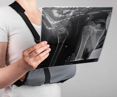 Shoulder Pain After an Auto Accident in Monterey Park