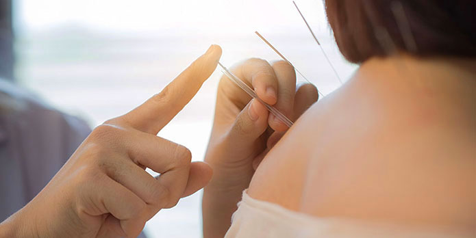 Monterey Park  acupuncture